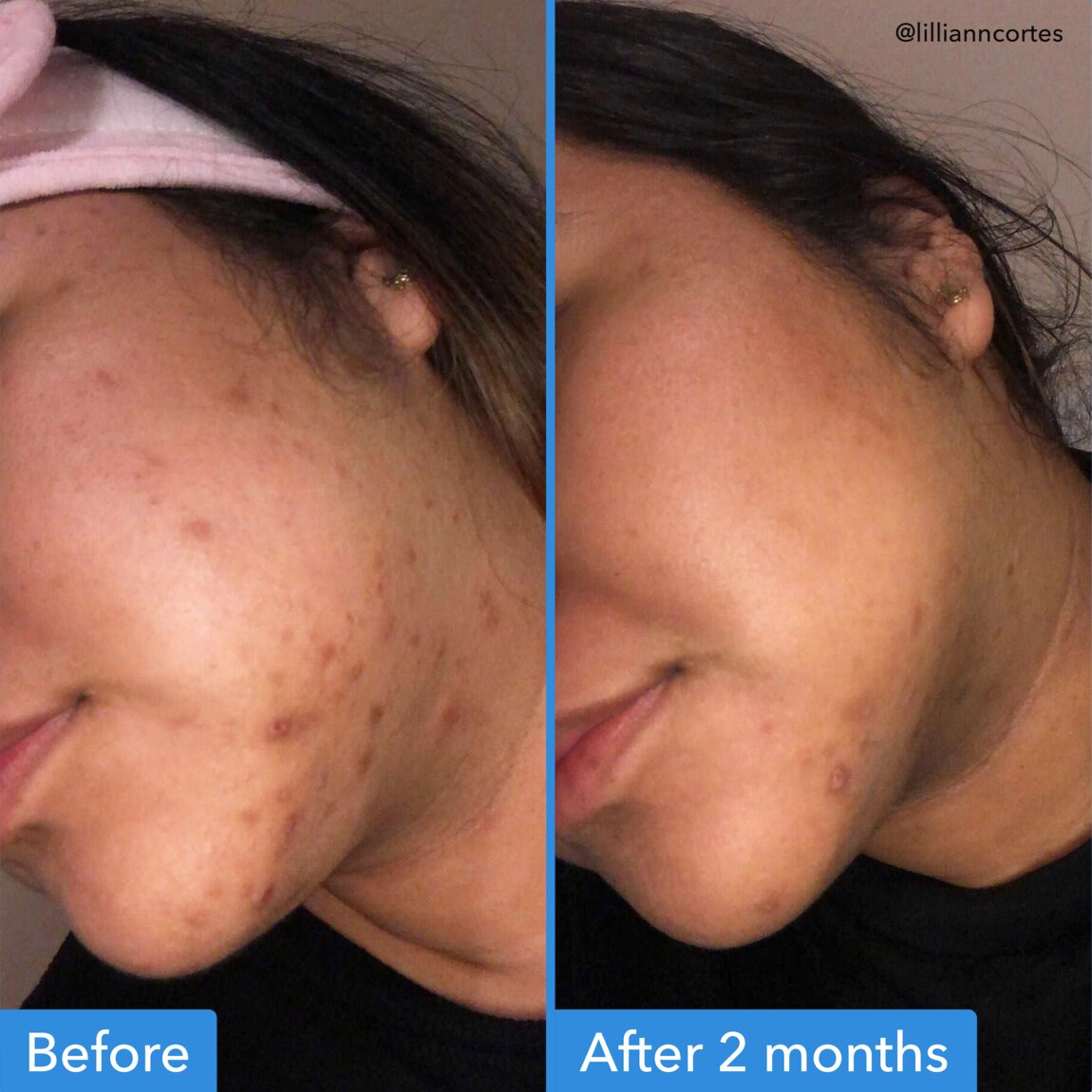 discoloration-correcting-serum-d0 zb_p.jpg