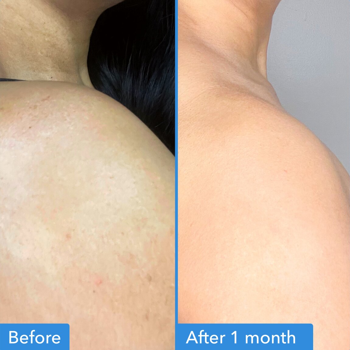 discoloration-correcting-body-treatment-z0 zb_p.jpg